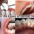 What are the types of dental treatment
