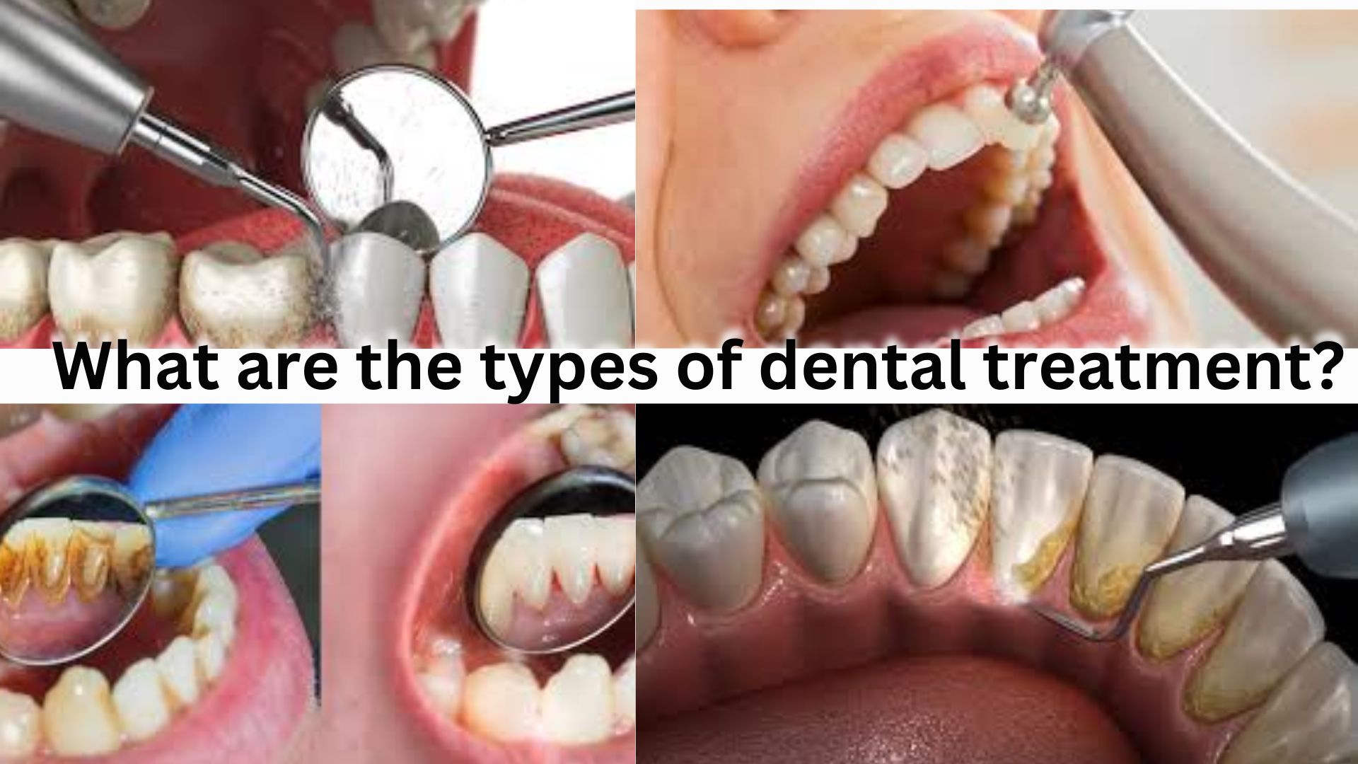 What are the types of dental treatment