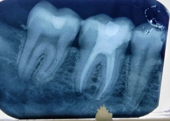 Dentcity-Multi-Speciality-Health-Dental-clinics-Orthodontist-Dum-Dum-Kolkata-West-Bengal-1