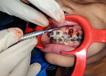 Gautam-Orthodontic-Dental-Clinic-Health-Dental-clinics-Orthodontist-Hyderabad-Telangana-2