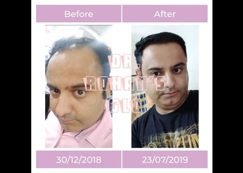 5 Best Hair transplant surgeons in Kolkata, WB 