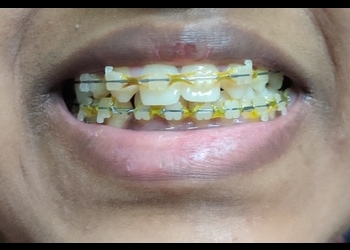 Teeth-Care-Multispeciality-Dental-Clinic-Health-Dental-clinics-Kolkata-West-Bengal-1