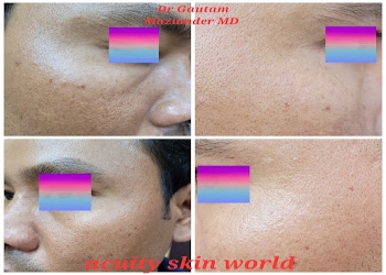 Acuity-skin-world-Dermatologist-doctors-Agartala-Tripura-1