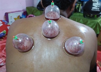 Ahmed-raza-hijama-Massage-spa-Bhilai-Chhattisgarh-1