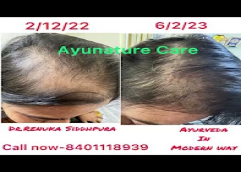 Ayunature-care-Dermatologist-doctors-Usmanpura-ahmedabad-Gujarat-2