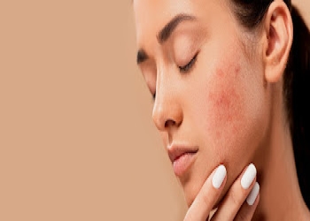 Dr-jsbist-dermatology-clinic-Dermatologist-doctors-Clock-tower-dehradun-Uttarakhand-2