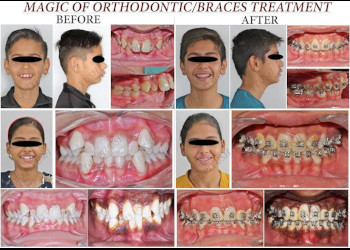 Dr-piyush-dental-clinic-advanced-dental-and-orthodontic-center-Dental-clinics-Agra-Uttar-pradesh-3