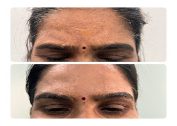 Forever-skin-clinic-Dermatologist-doctors-Vishrantwadi-pune-Maharashtra-2