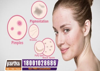 Partha-cosmetology-clinic-Dermatologist-doctors-Ameerpet-hyderabad-Telangana-2