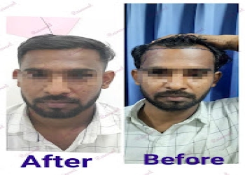 Reinvent-skin-hair-clinic-Dermatologist-doctors-Sangli-Maharashtra-1