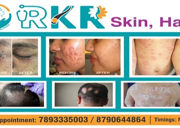 Rkr-skin-hair-laser-clinic-dr-b-ramadevi-Dermatologist-doctors-Tirupati-Andhra-pradesh-1