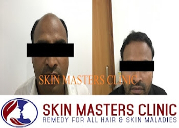 Skin-masters-clinic-Dermatologist-doctors-Panipat-Haryana-2