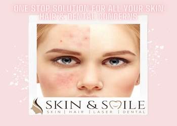 Skin-smile-clinic-Dermatologist-doctors-Navi-mumbai-Maharashtra-1