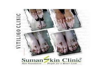 Suman-skin-clinic-Dermatologist-doctors-Haridwar-Uttarakhand-1