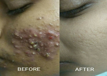 Trisha-skin-cosmetic-clinic-Dermatologist-doctors-Vadodara-Gujarat-1