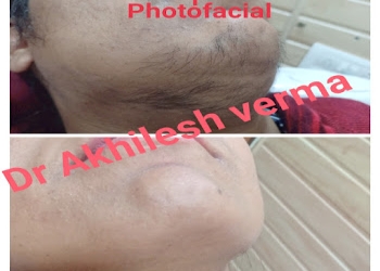 Verma-singla-dermatology-clinic-Dermatologist-doctors-Paota-jodhpur-Rajasthan-1