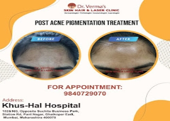 Verma-skin-and-hair-clinic-Dermatologist-doctors-Vikhroli-mumbai-Maharashtra-1